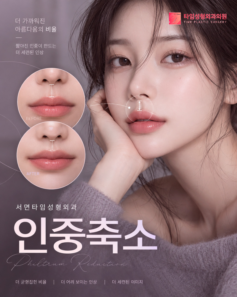 서면인중축소 후 흉터가 코 밑에 얼마나 남을까? 사진 2