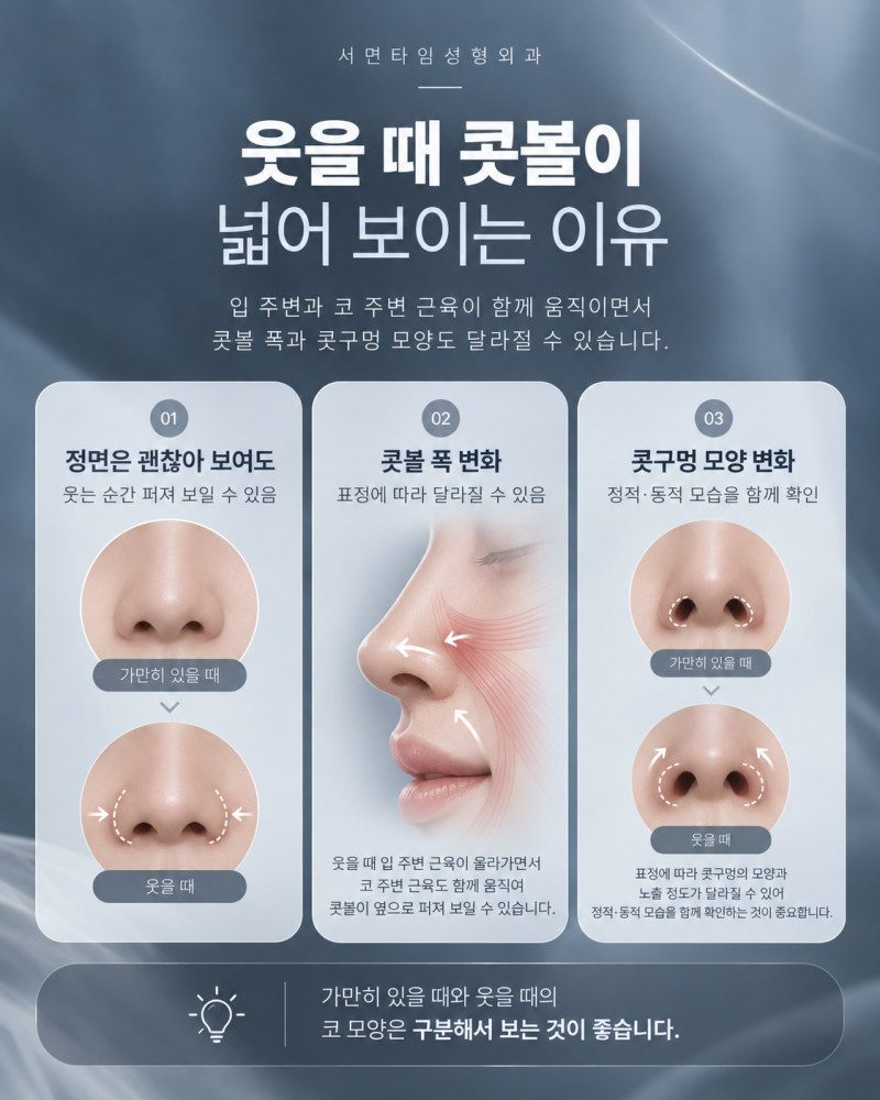 서면콧볼축소 후 웃을 때 어색해 질 수 있나요? 사진 4